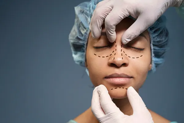 La rinoplastia es una cirugía delicada que requiere ciertos cuidados en el postoperatorio. Una de las preguntas más frecuentes es si se puede tomar alcohol después de una rinoplastia. En...