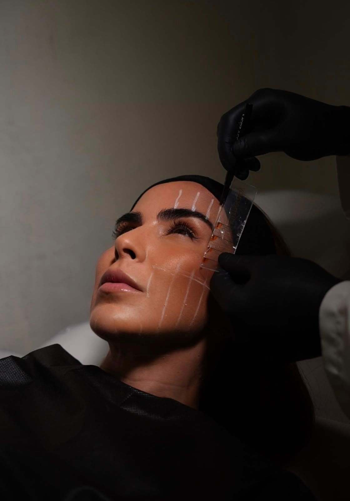 Tecnología Médica Vanguardia Ultherapy Prime 1