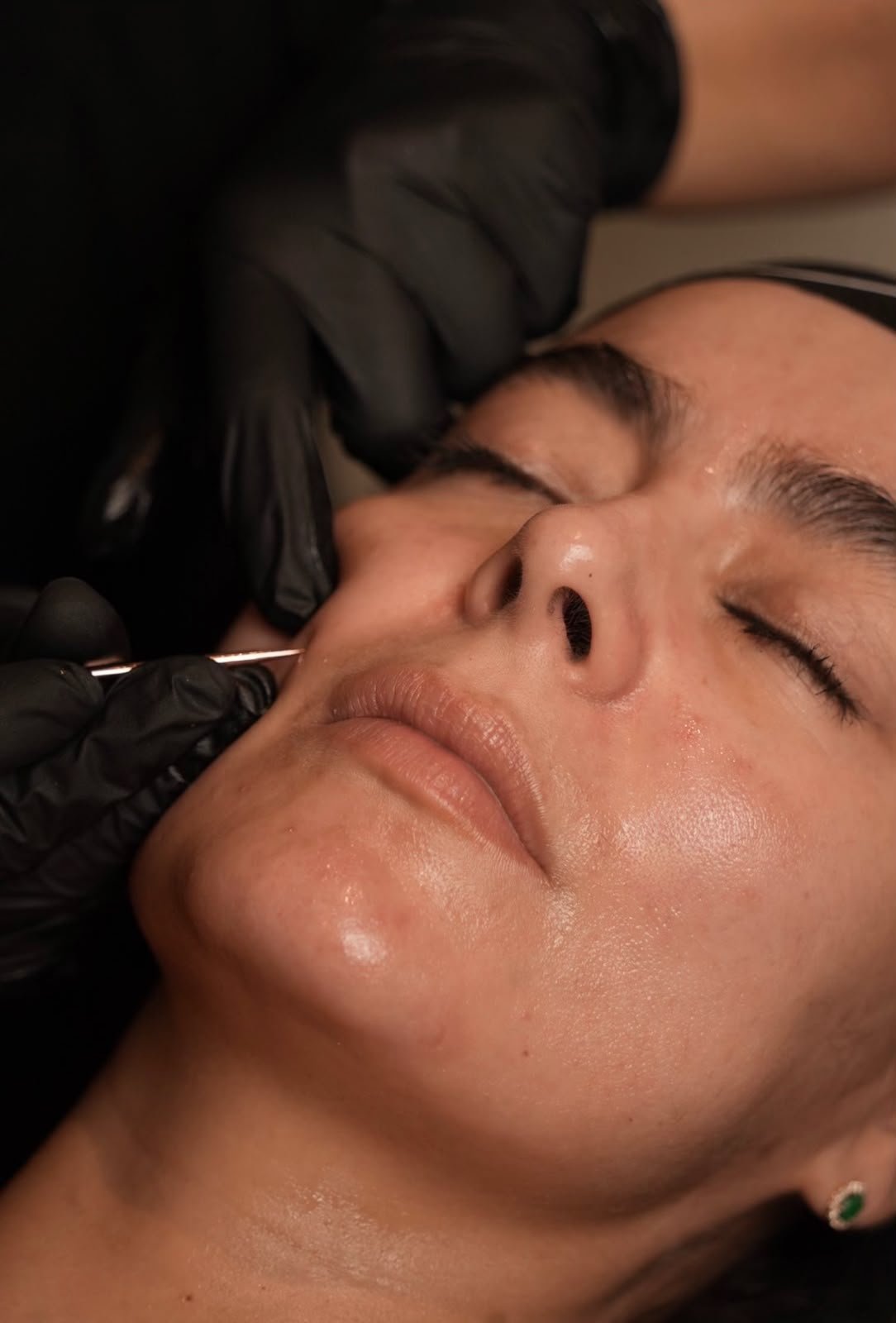 Limpieza Facial New Krystal