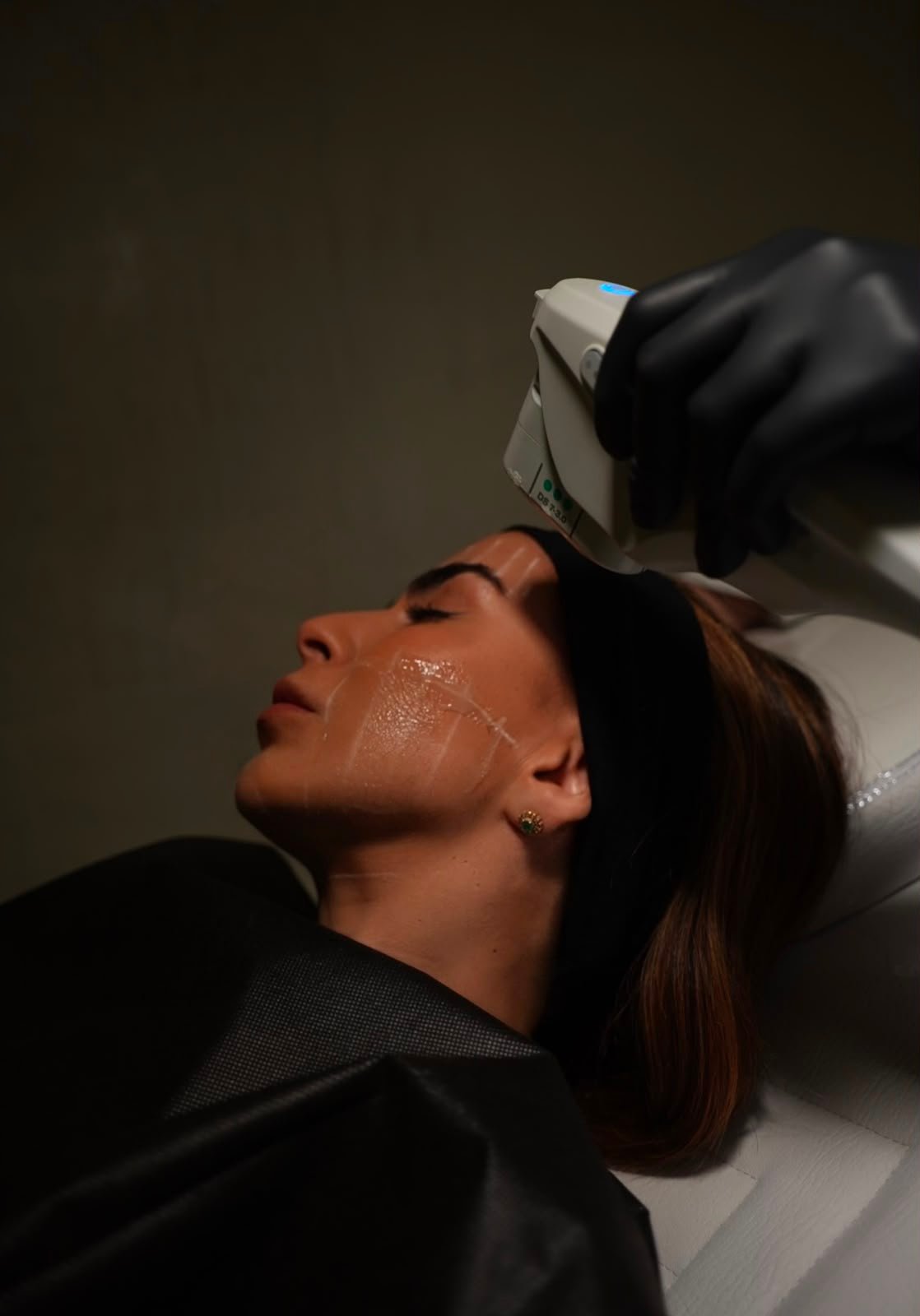 Tecnología Médica Vanguardia Ultherapy Prime 2
